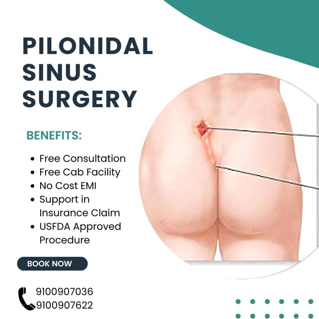 Pilonidal Sinus