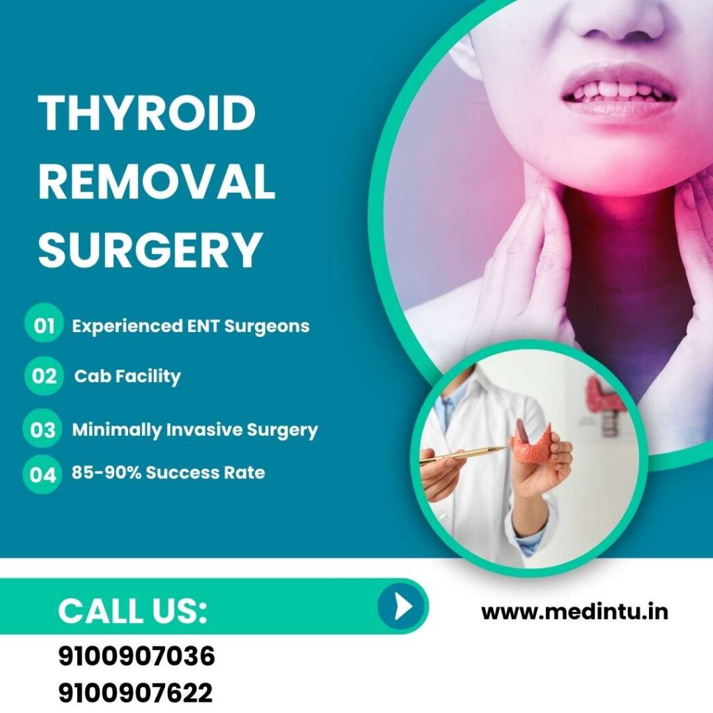 Thyroidectomy