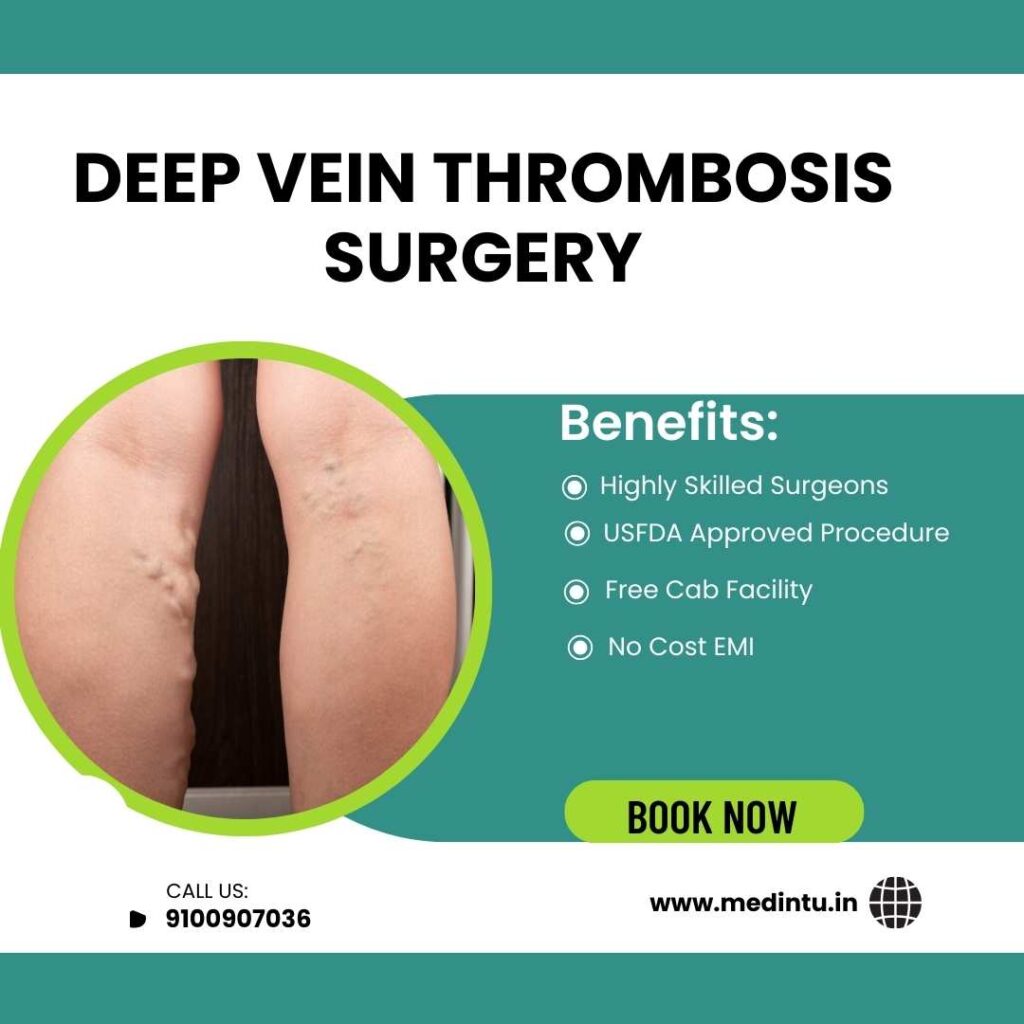 Deep vein Thrombosis
