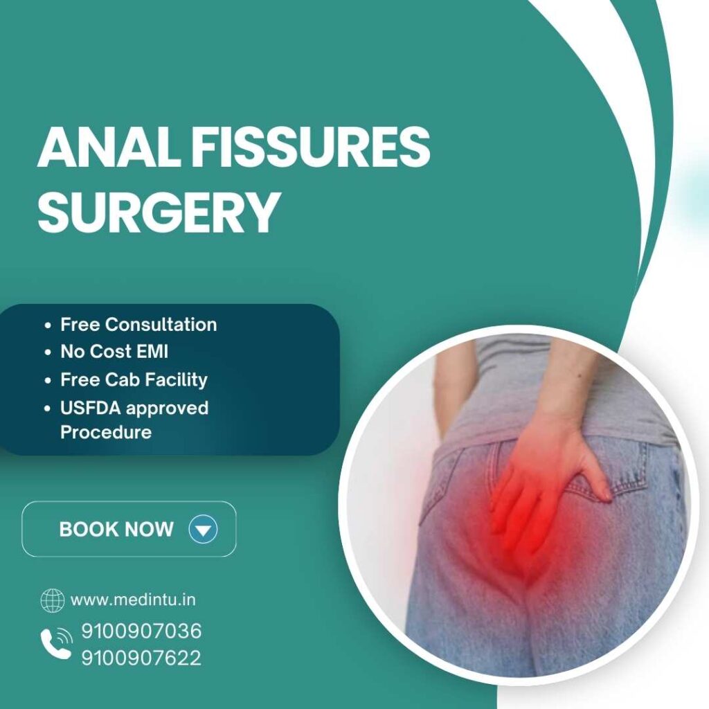 Anal Fissures