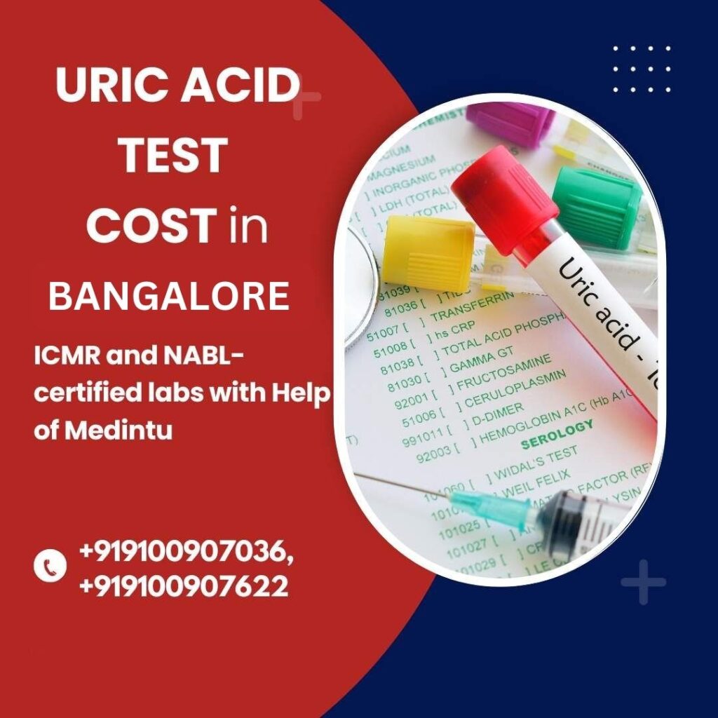 Uric Acid Test in Bangalore