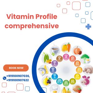 Vitamin Profile comprehensive