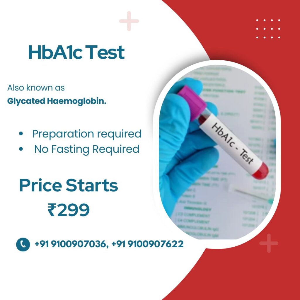 HbA1c Test