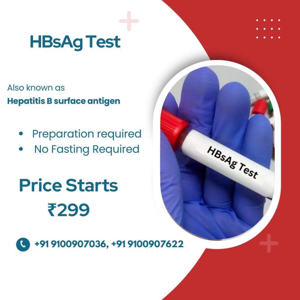 Hbsag test