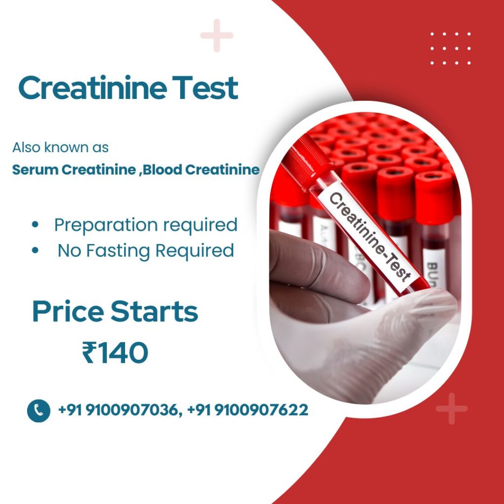 Creatinine Test