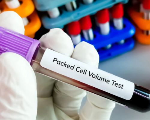 PCV Test