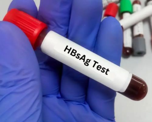 hbsag test