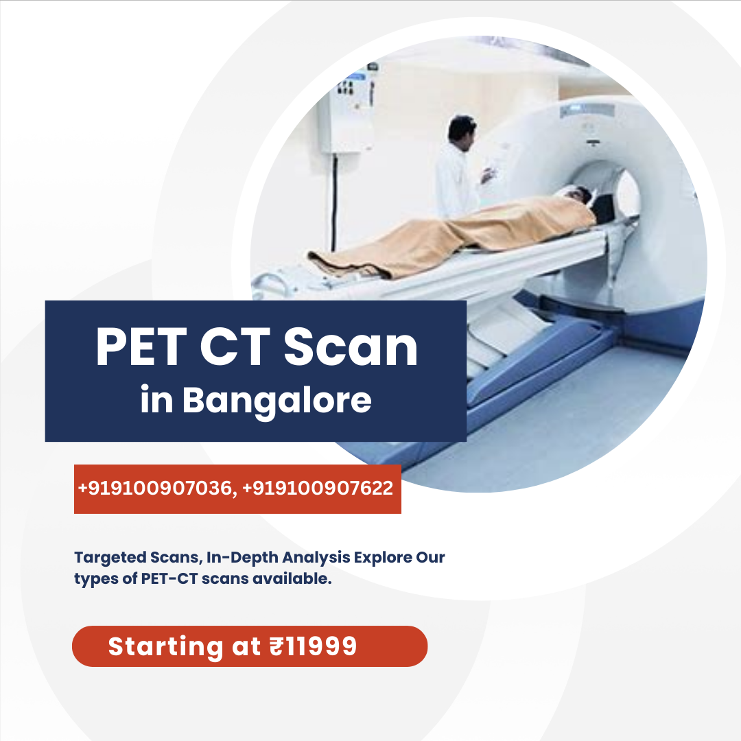 Pet CT Scan in Bangalore