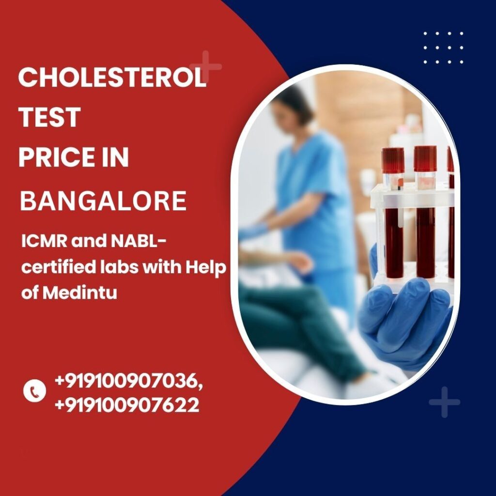 Cholesterol test in Bangalore