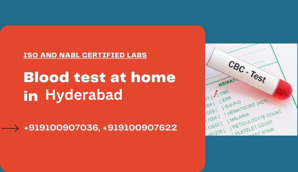 Blood test at home hyderabad