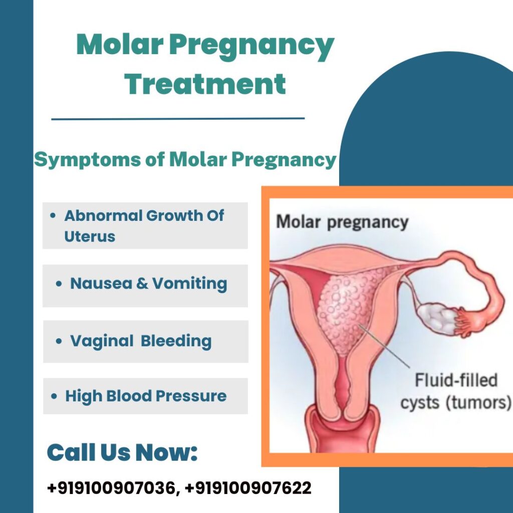 Molar Pregnancy Treatment
