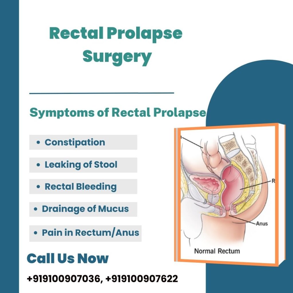 Rectal prolapse surgery