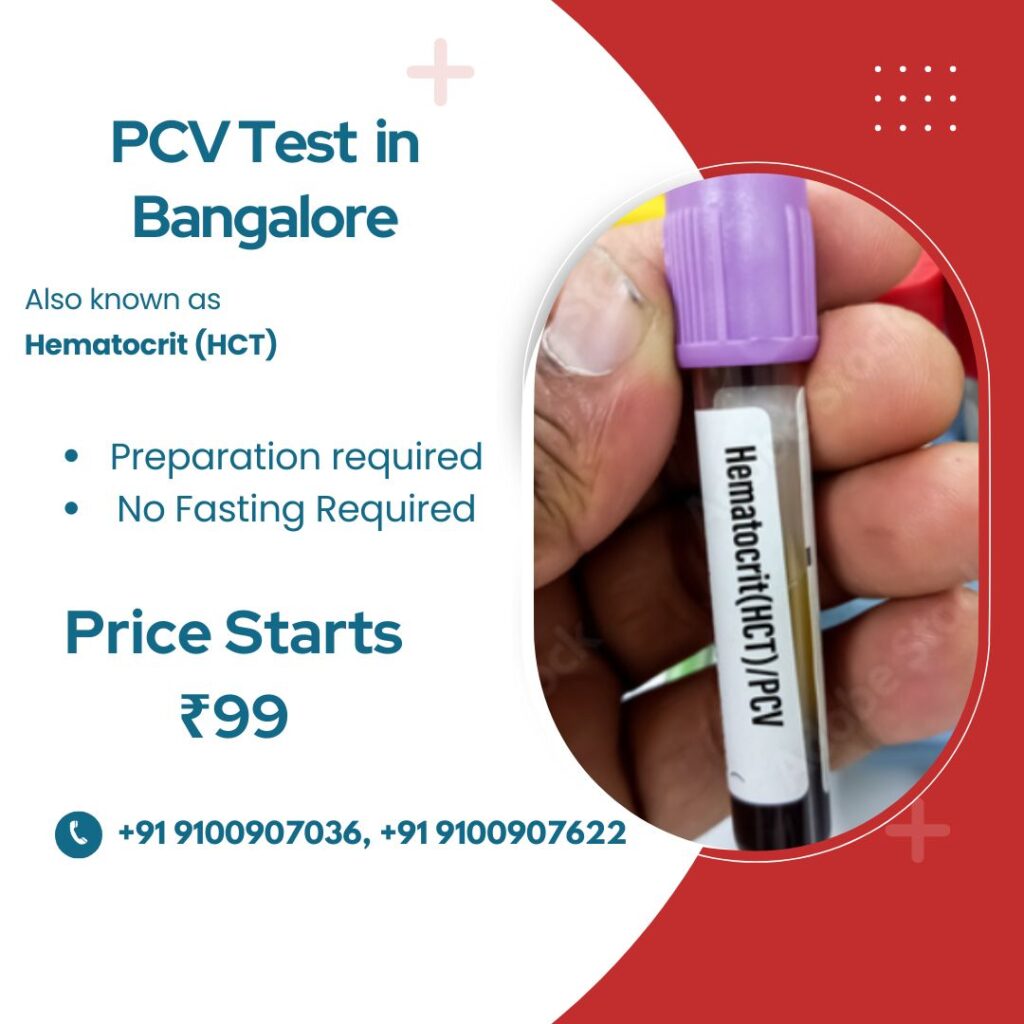PVC Test in Bangalore
