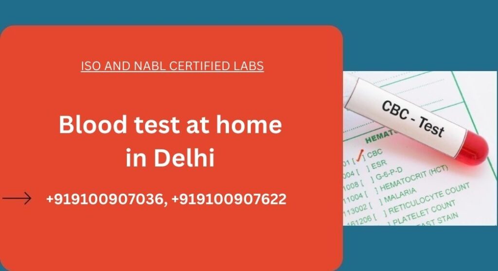 Blood Test at home in Delhi