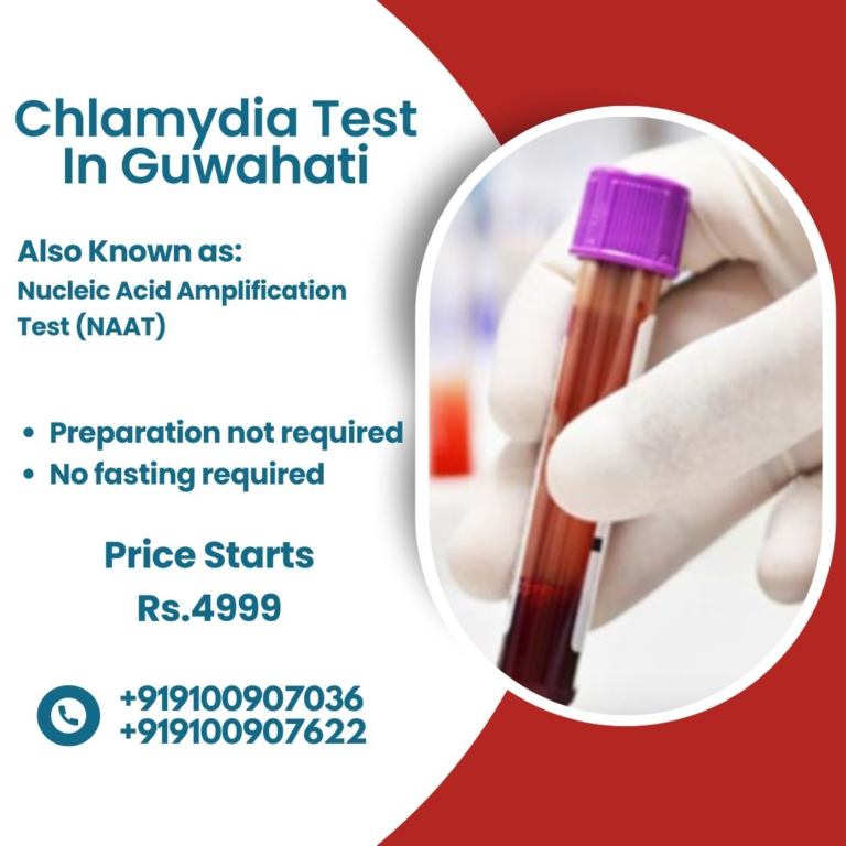 Chlamydia Test At Home In Guwahati | Medifyhome