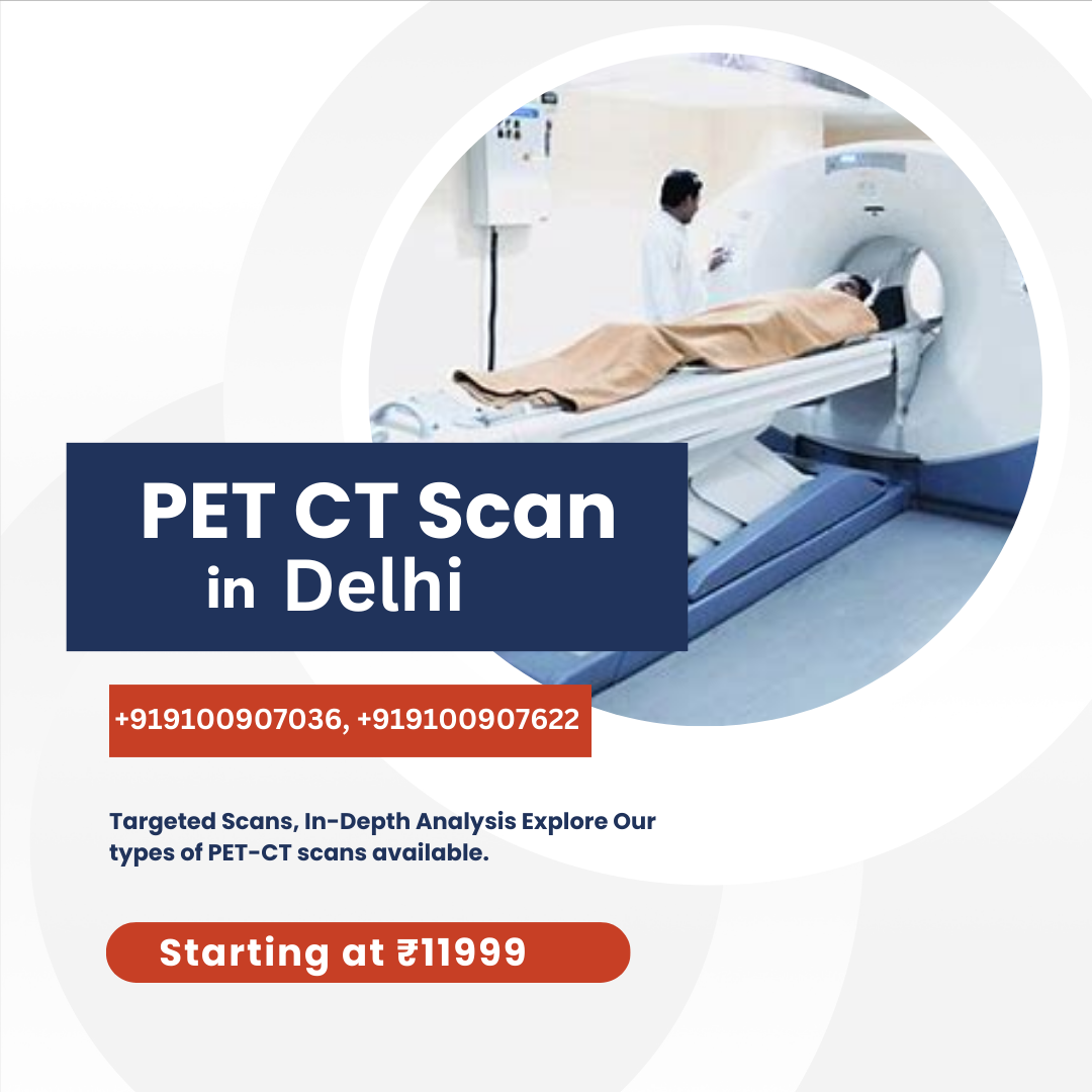 Pet CT Scan in Delhi