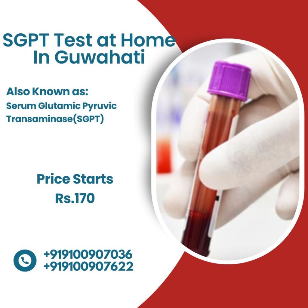 SGPT Test at Home in Guwahati