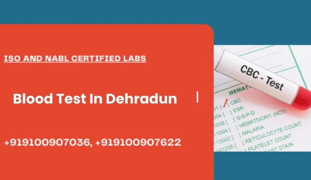 Blood Test In Dehradun