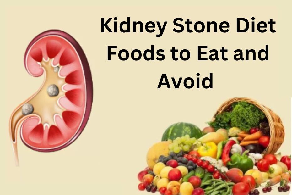 Kidney Stone diet