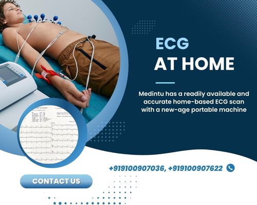 Ecg at home