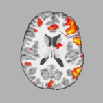 Functional MRI