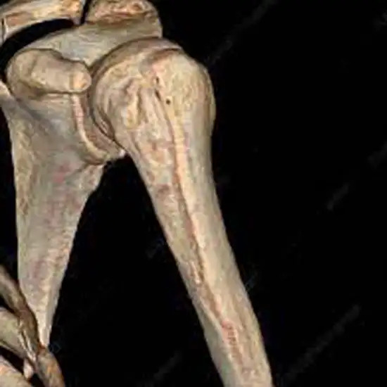 3D-CT-Shoulder