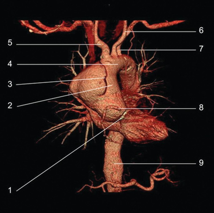 CT Angiography Thoracic