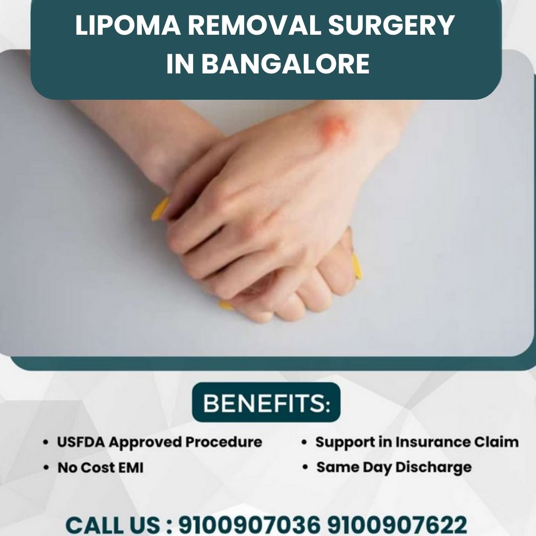 LIPOMA REMOVAL SURGERY IN BANGALORE