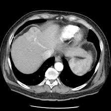 MRI-Abdomen-Triple-Phase