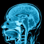 MRI Brain + Face Plain