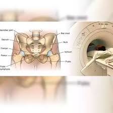 MRI Pelvis With Contrast