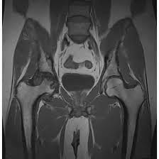 MRI Sinogram