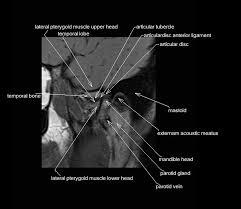 MRI-TM-Joint