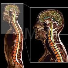 NCCT Cervical Spine
