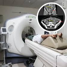 NCCT Pelvis
