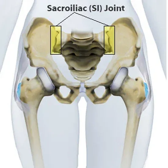 MRI Sacroiliac Joint