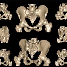 3D CT Hip Joint