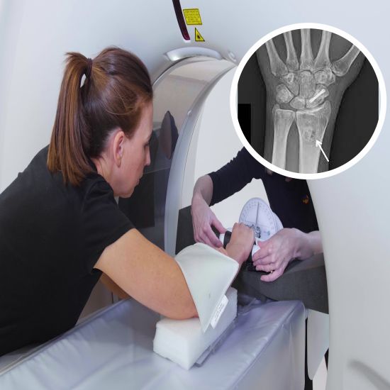 CECT Right Wrist Joint | Medifyhome
