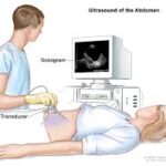 Lower Abdominal Ultrasound