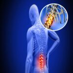 MRI of the Low Backache Protocol