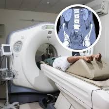 NCCT Lower Abdomen