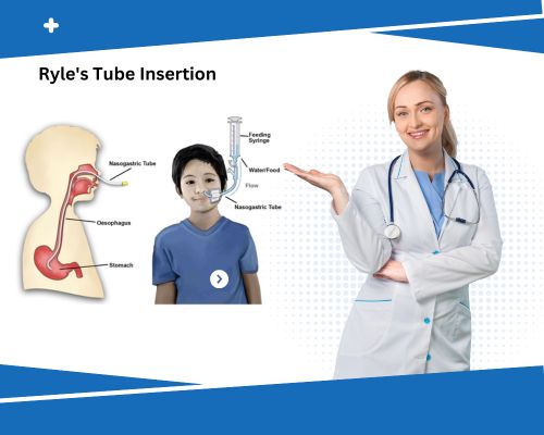 Ryle’s Tube Insertion Ryle's Tube Insertion