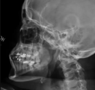 X-Ray TM Joints Right