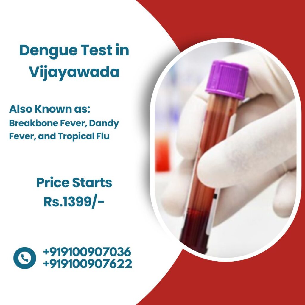 Dengue Test In Vijayawada