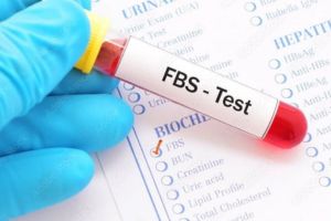 Blood Sugar (FBS )