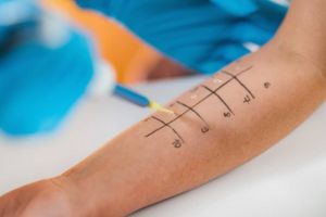 Allergy Screening