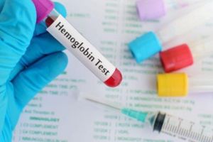 Hemoglobin Test