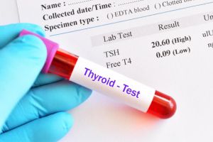 thyroid test