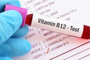 Vitamin B12 Test