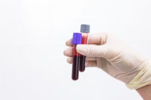vital screening Package